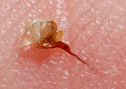 CLOSE-UP of a bee sting. (Photo by Kathy Keatley Garvey)