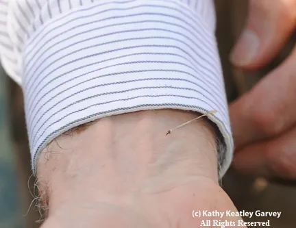 FOURTH PHOTO--A strand of abdominal tissue. (Copyrighted, All Rights Reserved, Photo by Kathy Keatley Garvey)