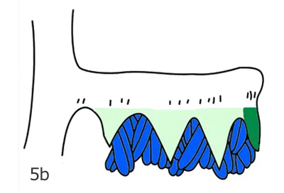 Figure 5b. Walnut: male flower containing only sepals (light green), a bract (dark green), and anthers (blue).