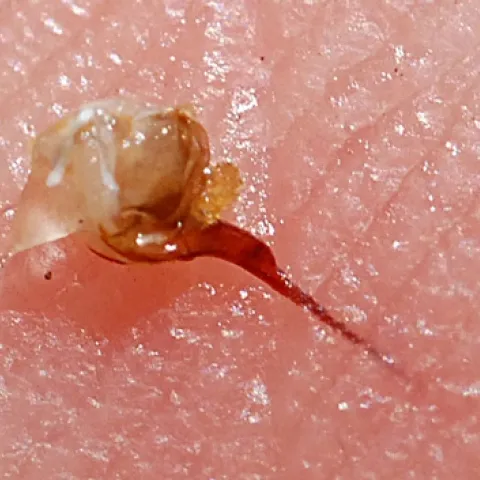CLOSE-UP of a bee sting. (Photo by Kathy Keatley Garvey)