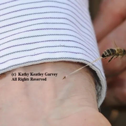This photo of a bee sting, by Kathy Keatley Garvey, appears in Sarah Albee's book, "Bugged."