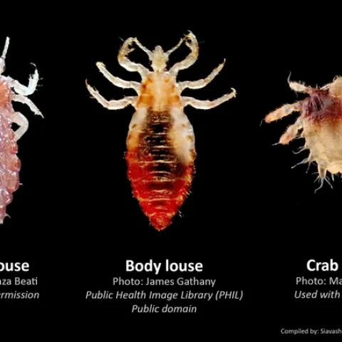Side by side images of a head louse, body louse, and crab louse.