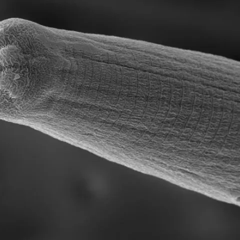 A scanning electron micrograph of a nematode, a Steinernema carpocapsae, spitting venom. (Image by Adler Dillman)