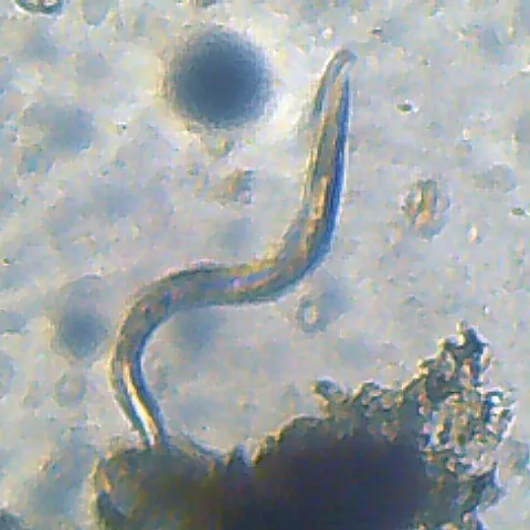 This is the root-knot nematode, Meloidogyne chitwoodi, that Cynthia Gleason of Washington State University studies. (Image courtesy of Wikipedia)