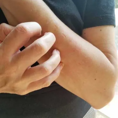 A person wearing a black shirt scratching their forearm.
