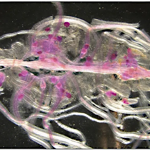 Nematodes infecting bean roots. (Image by Pallavi Shakya)