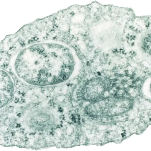 ransmission electron micrograph of Wolbachia within an insect cell. (Wikipedia)