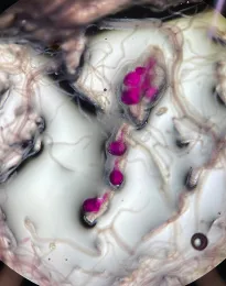 Root galling on a tomato plant that is infected with root-knot nematodes.