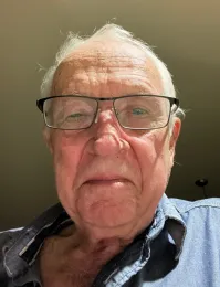 Dan Hemesath's right eye is swollen after being exposed to sap in silver spurge.