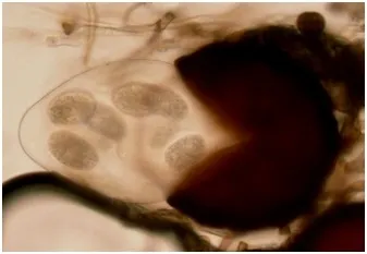 Podosphaera aphanis-cleistothecium-David Gadoury