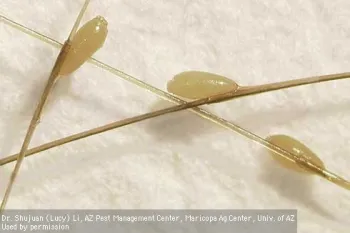 Head lice eggs. (Photo: Dr. Shujuan [Lucy] Li)