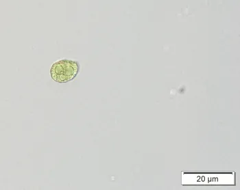 Liverwort spores close up