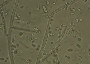 Raffaelea montetyi by Dr. Akif Eskalen, UC Davis