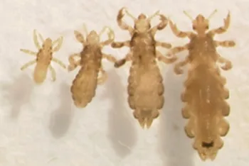 Fases en el desarrollo de un piojo.