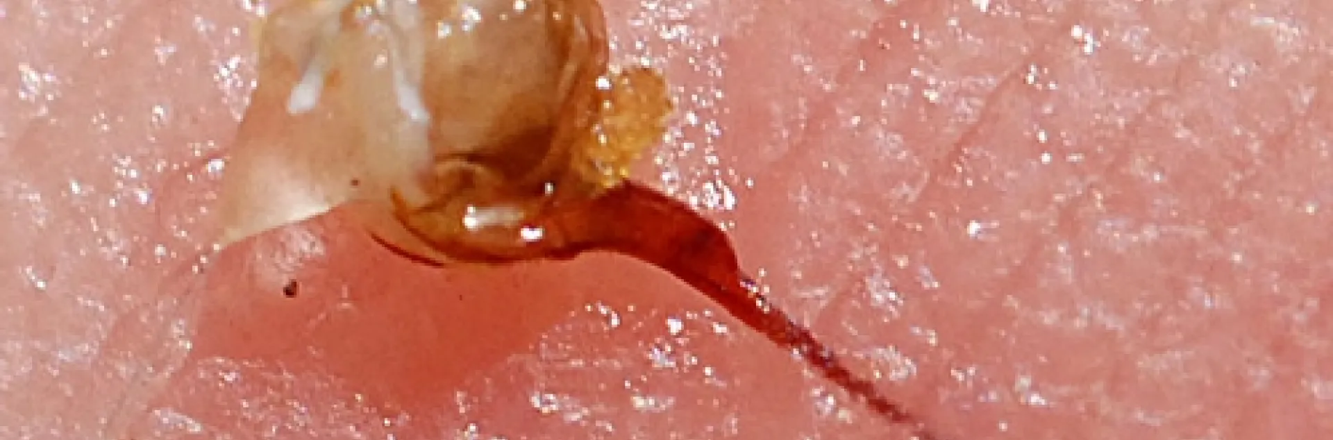 CLOSE-UP of a bee sting. (Photo by Kathy Keatley Garvey)