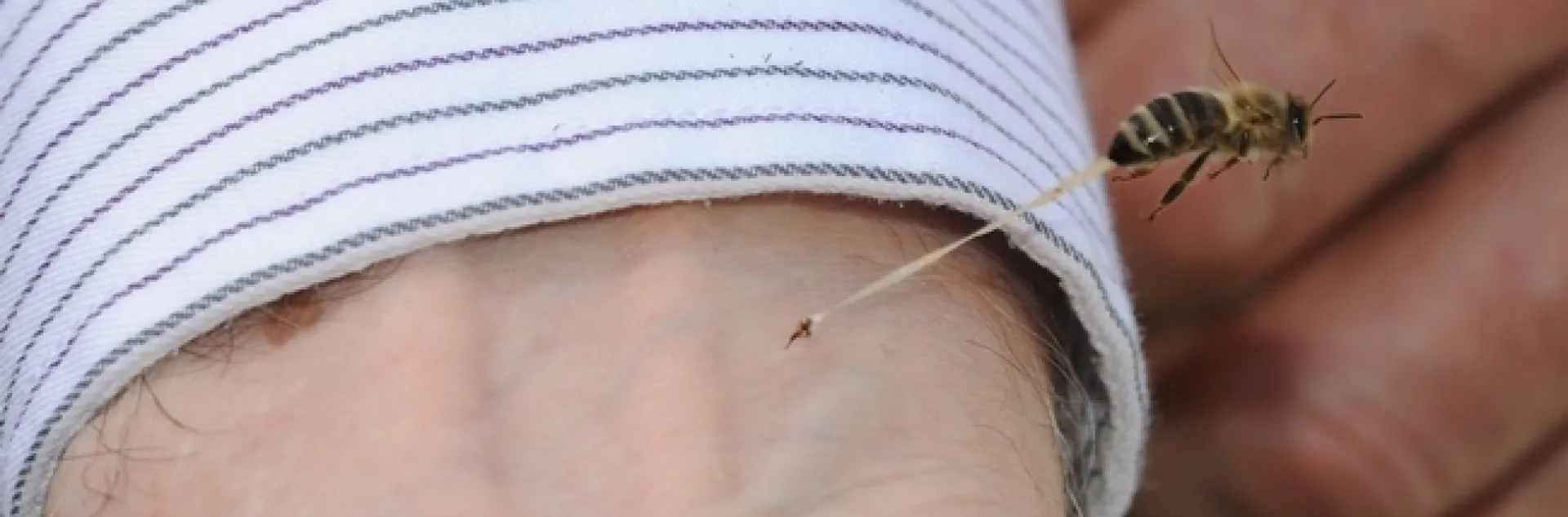 Honey bee stinging Extension apiculturist Eric Mussen. (Photo by Kathy Keatley Garvey)