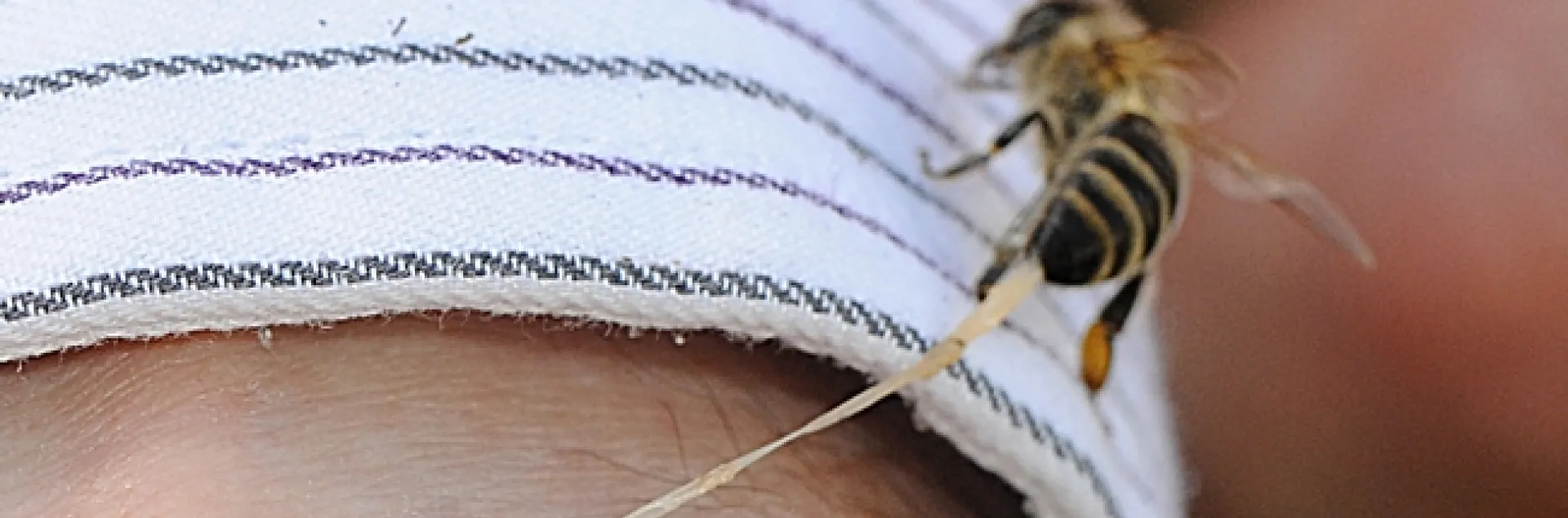 This photo, appearing in the field guide, is of Extension apiculturist Eric Mussen being stung by a honey bee. (Photo by Kathy Keatley Garvey)