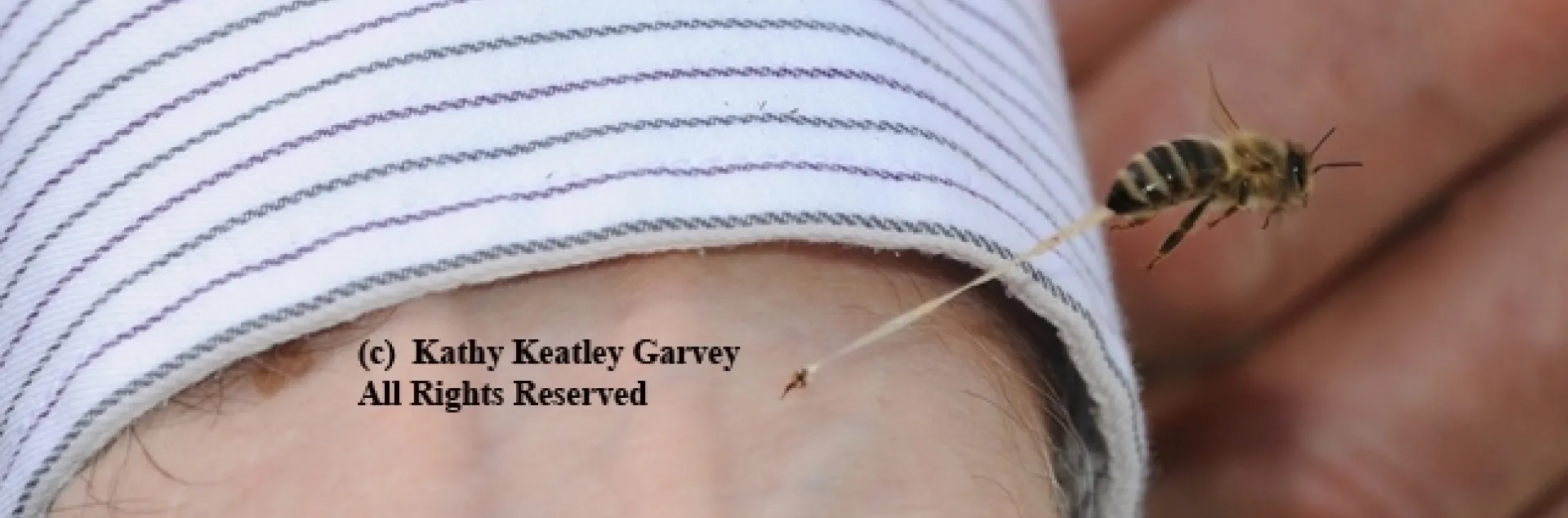 This photo of a bee sting, by Kathy Keatley Garvey, appears in Sarah Albee's book, "Bugged."
