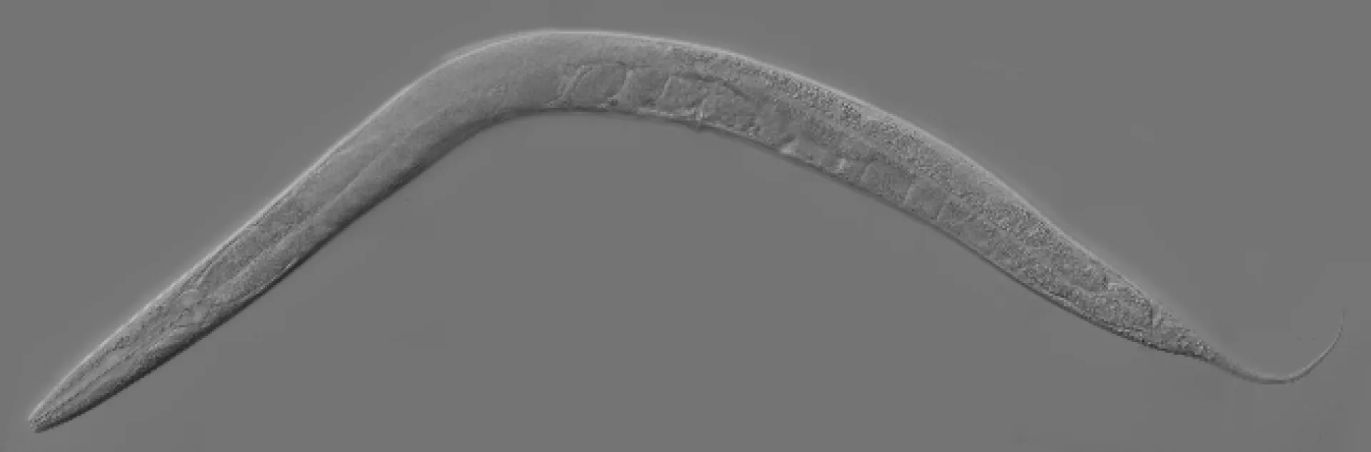 Adult Caenorhabditis elegans. Wikipedia describes it as "a free-living, transparent nematode, about 1mm in length, that lives in temperature soil environments." (Courtesy of Wikipedia)