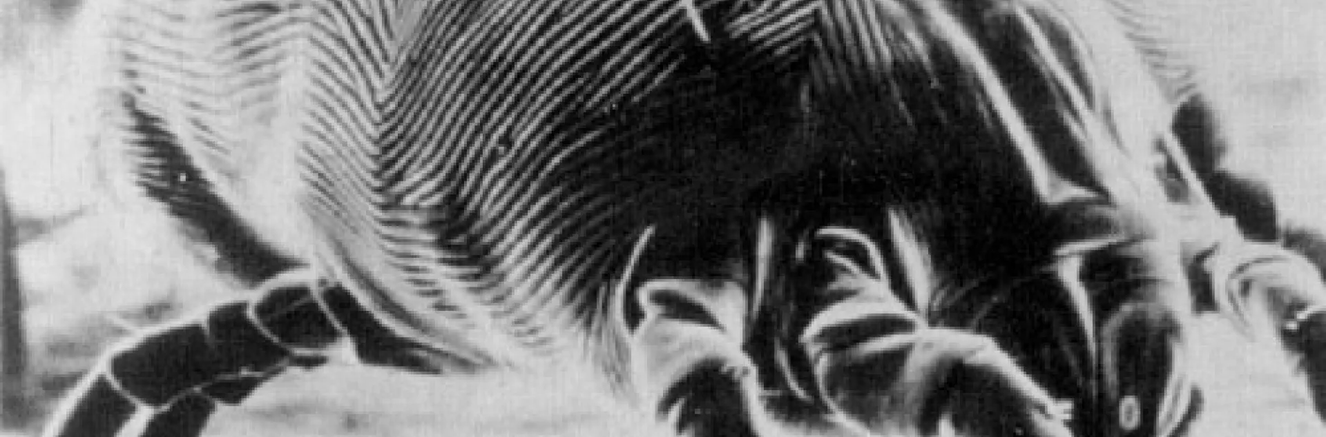 S.E.M. Micrograph of a female dust mite.